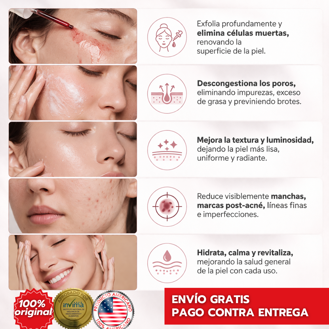 Peeling Facial Efecto Piel Nueva – Piel Más Lisa, Sin Manchas ni Acné