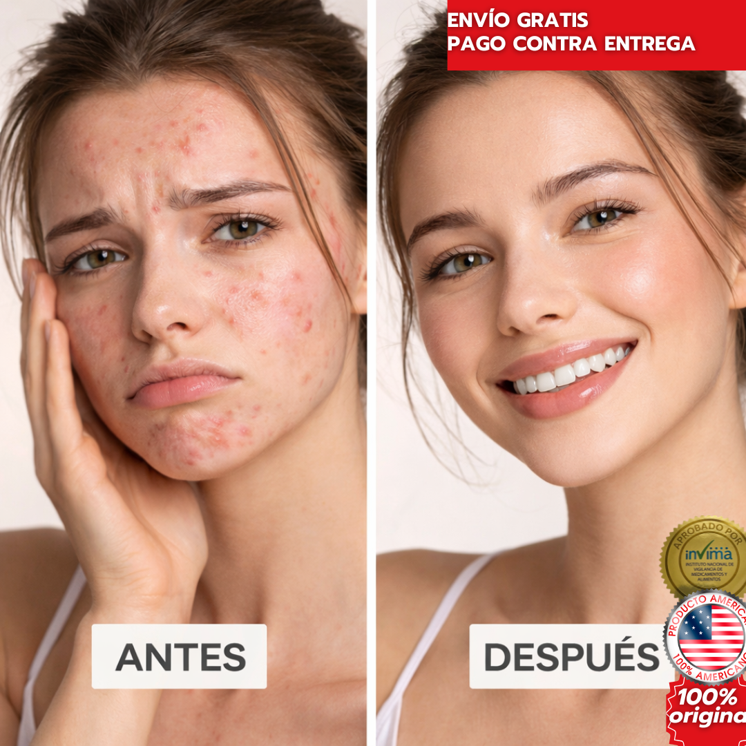 Peeling Facial Efecto Piel Nueva – Piel Más Lisa, Sin Manchas ni Acné